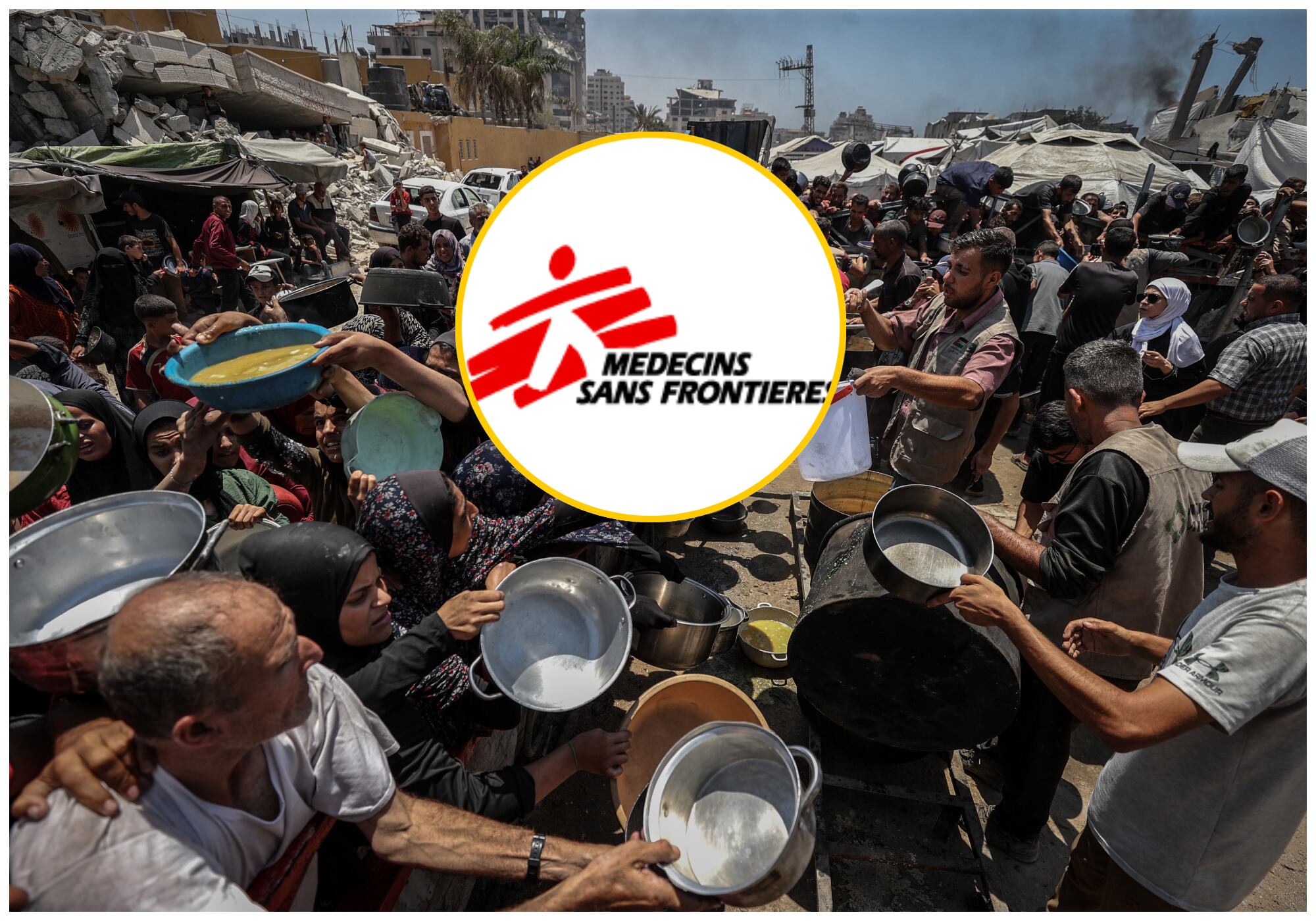 Alarmante revelación de Médicos Sin Fronteras sobre niños y mujeres embarazadas en Gaza. Foto: EFE.