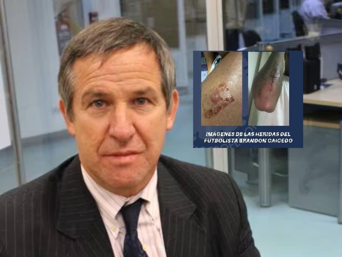 ¿Qué dijo el presidente de Acolfutpro sobre la agresión que sufrió un jugador del Deportes Quindío?