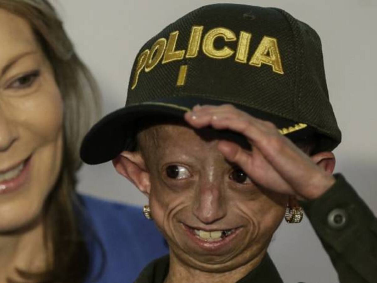 Murió a los 16 años, Magali González, la niña que padecía envejecimiento prematuro