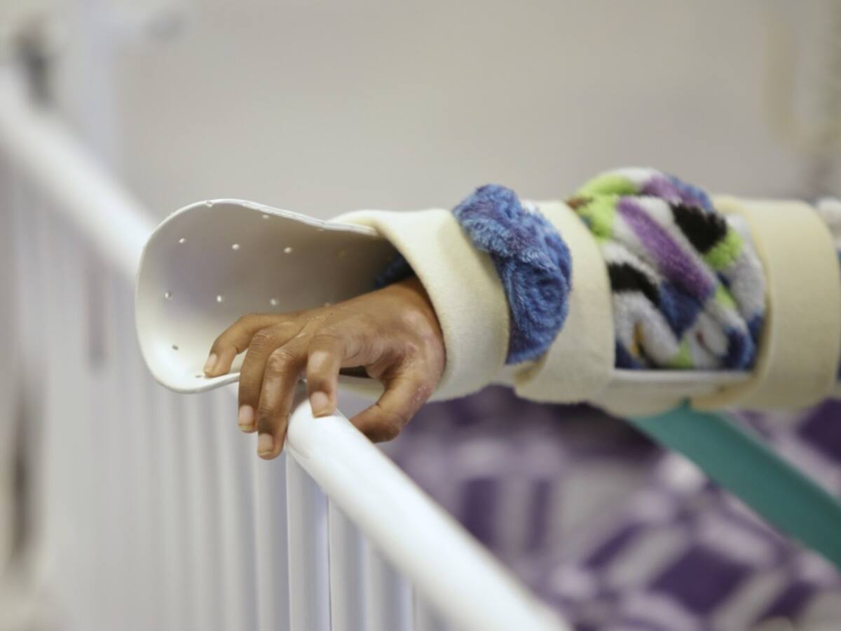 Atlántico, el departamento con más quemados en todo el país