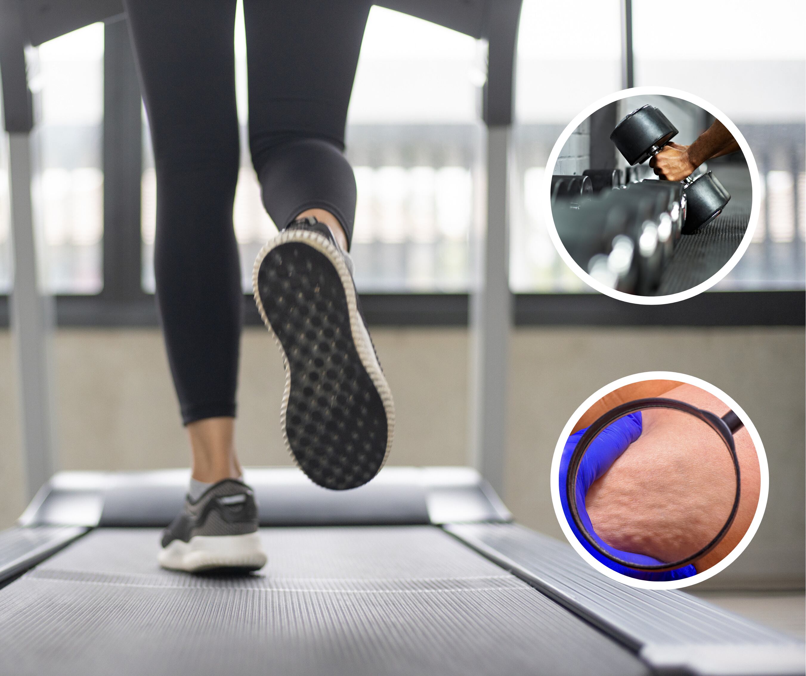 Persona en una caminadora junto a unas pesas y una lupa enfocando la piel (Getty Images)