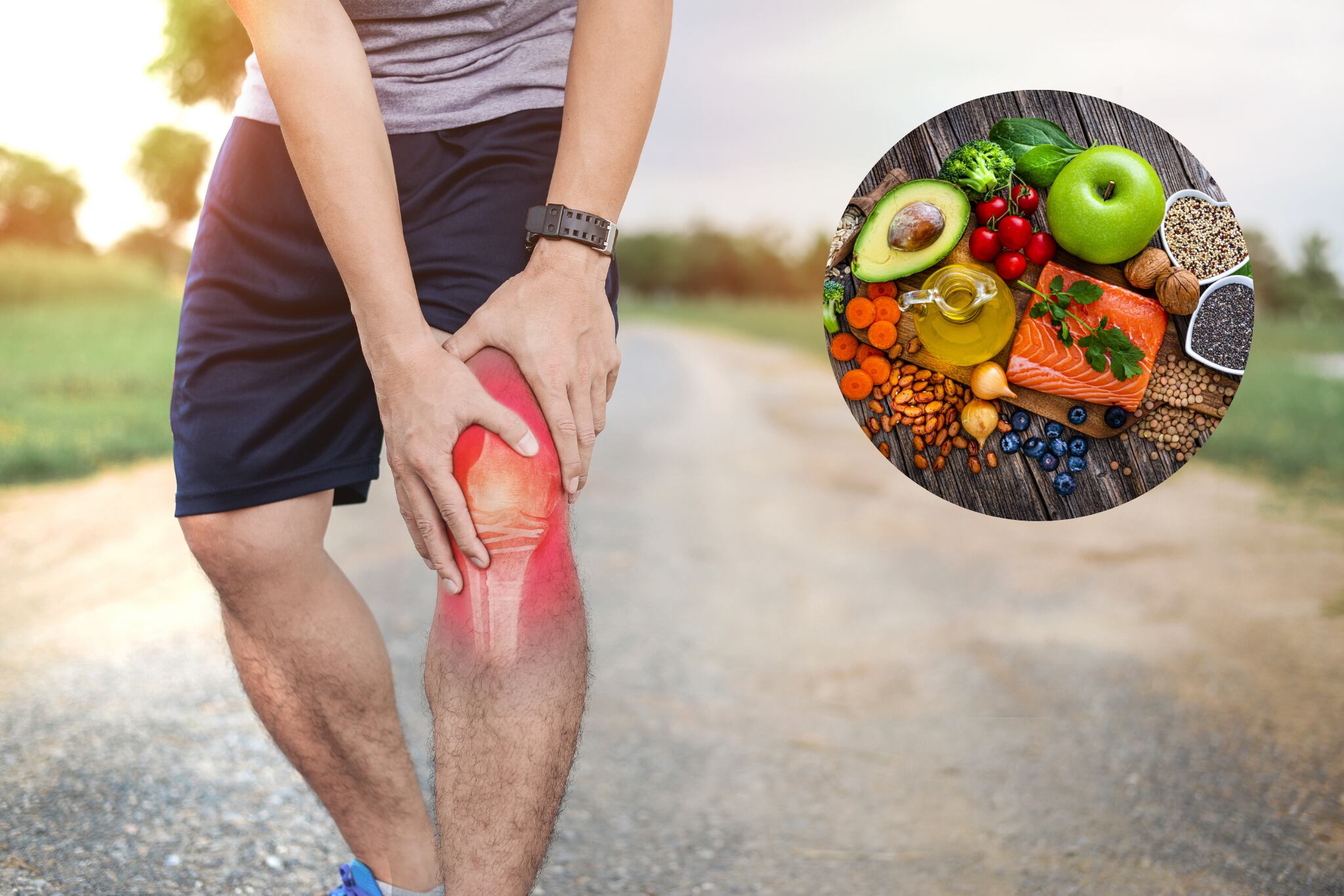 Alimentos que ayudarían a 'frenar' la artrosis - Getty Images