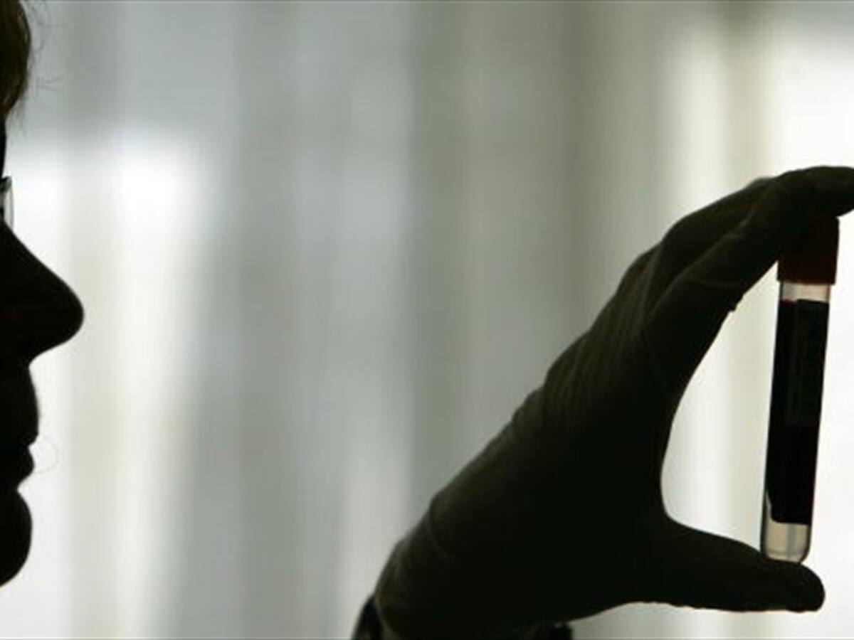 Descubren gen que activaría genéticamente el Alzheimer