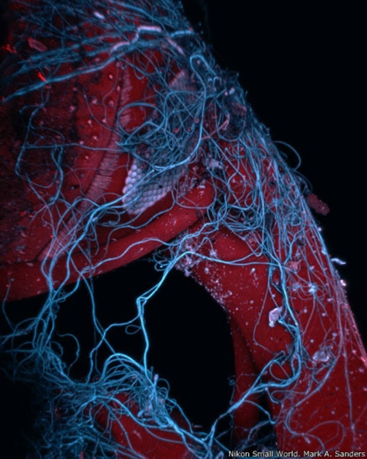 8º - Magdalena Turzanska, del Instituto de Biología Experimental de la Universidad de Breslavia (Polonia). Imagen de una planta briofita (Barbilophozia) y de una cianobacteria.