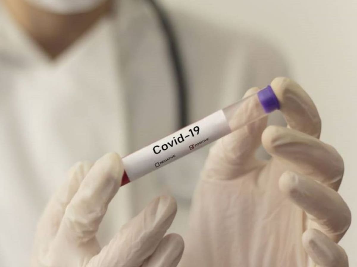 24 casos de Coronavirus en Arauca