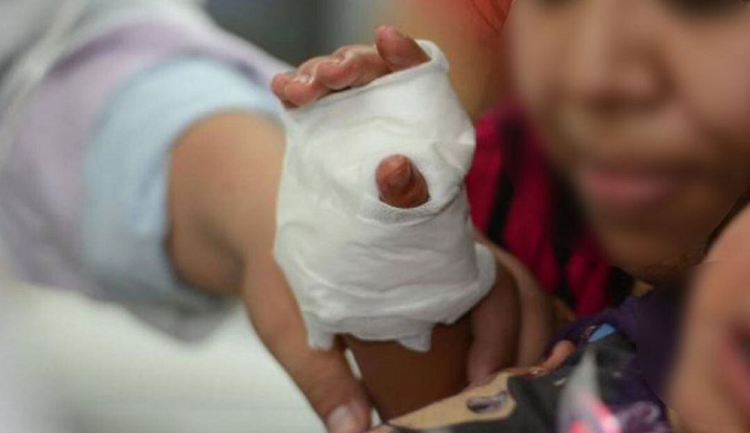 Menores de edad los más afectados por uso de pólvora en el Huila.