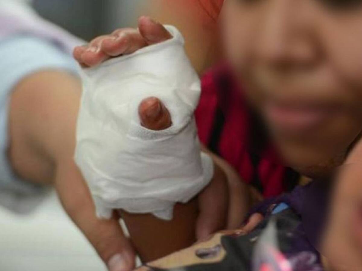 Menores de edad los más afectados por uso de pólvora en el Huila
