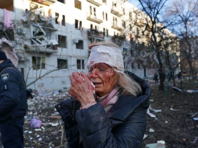 Mujer ucraniana herida tras un bombardeo en su apartamento en la ciudad de Kharkiv.          Foto: Getty 