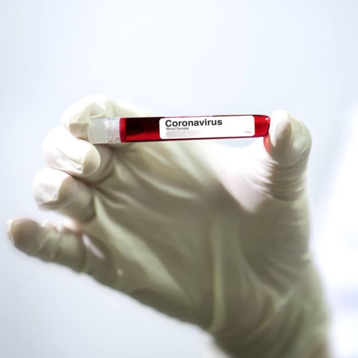 Gobernador de Boyacá y alcalde de Tunja dieron negativo para Coronavirus