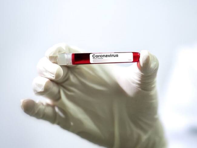 Norte de Santander reportó 32 nuevos casos de Coronavirus