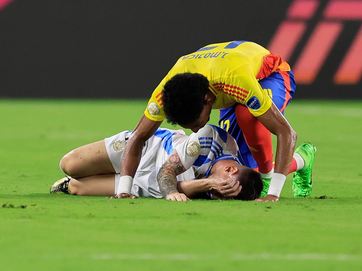 Increíble: así quedó el tobillo de Lionel Messi luego de la final contra Colombia