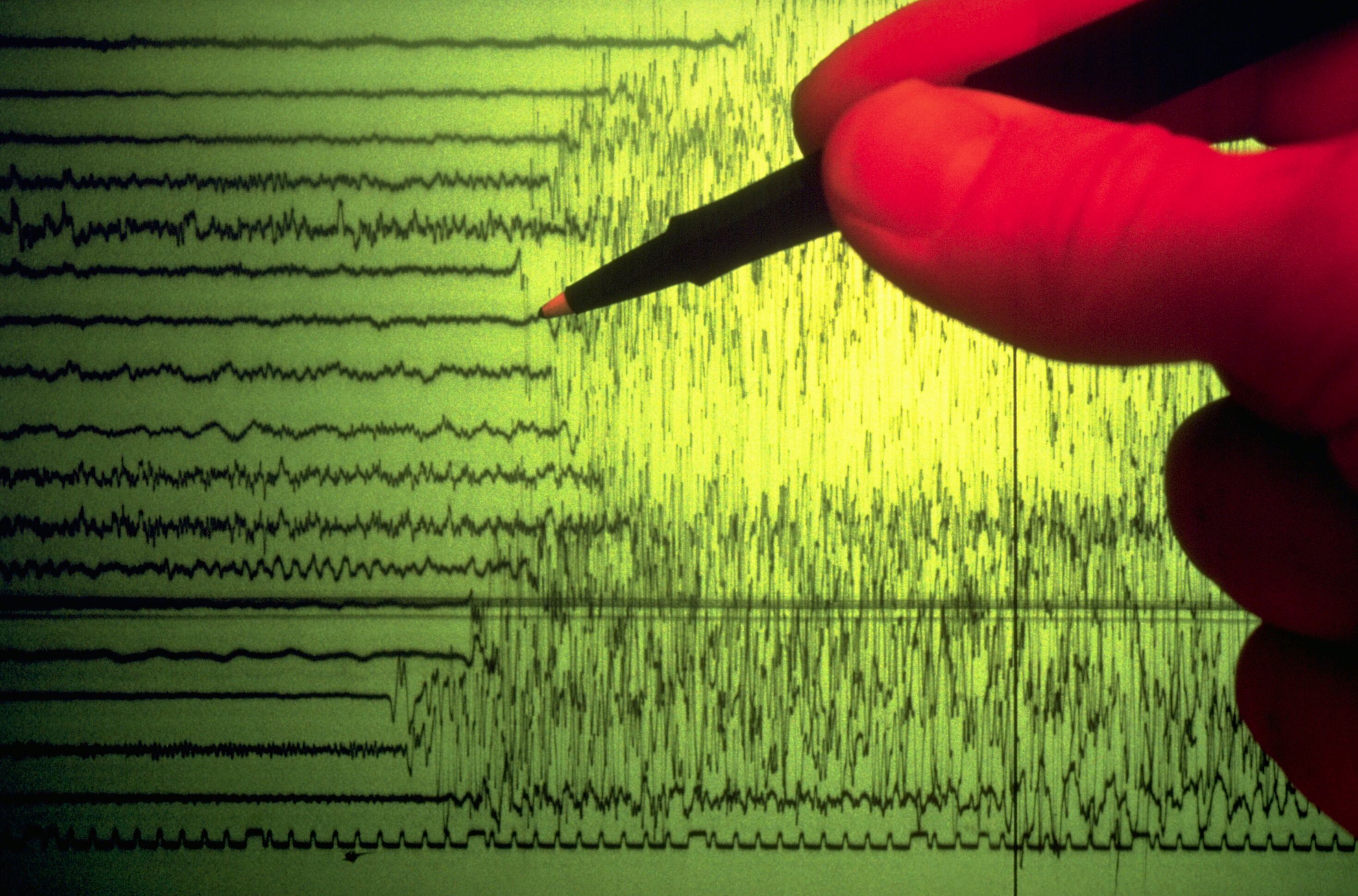 Sismógrafo detecta un temblor. 
(Foto: Getty Images)