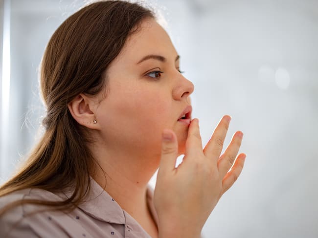 Labios secos, imagen de referencia | Getty Images