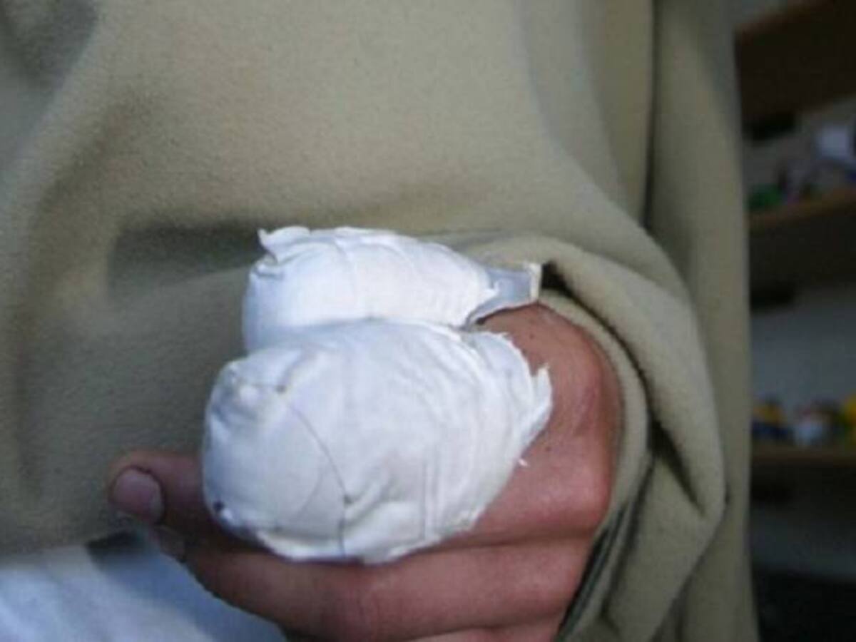 Niño de 9 años resulto herido por explosión de un artefacto abandonado