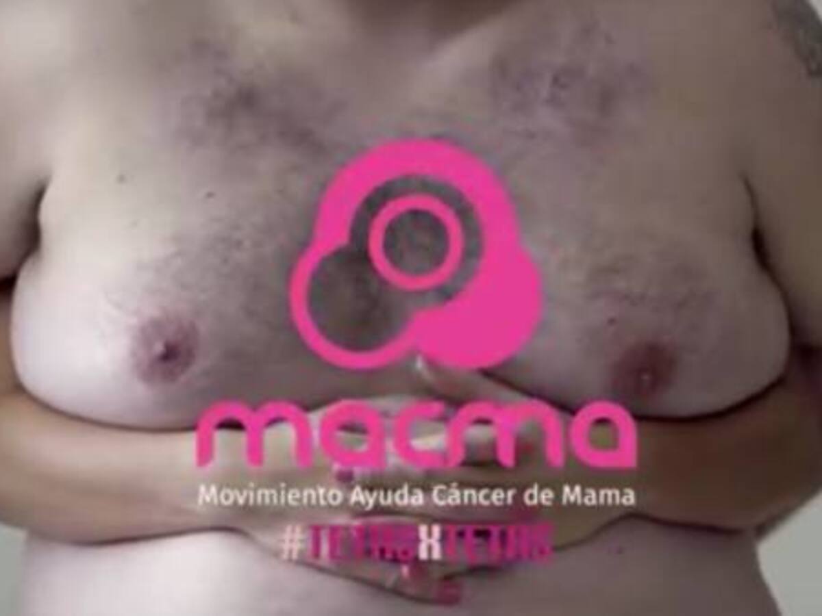 El cáncer de mama también lo sufren los hombres