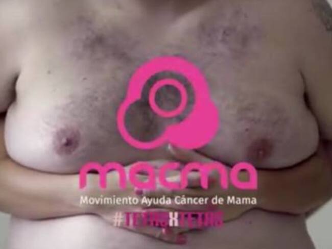 Sanamente cáncer de mama en hombres