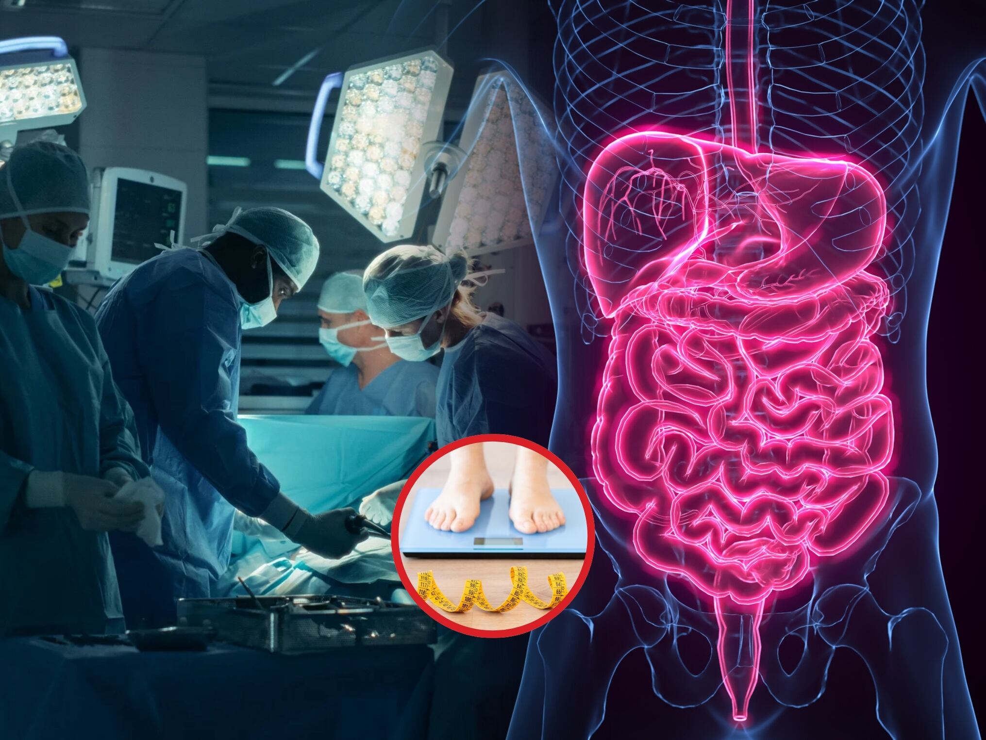 A la izquierda: Imagen ilustrativo de varios cirujanos haciendo una intervención quirúrgica. A la derecha: Referencia del sistema digestivo. Abajo en el centro: Imagen de referencia de una persona consultando su peso corporal (Crédito: Getty Images)