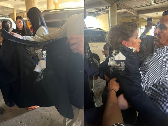 La diputada Gladys López, quien se recupera del ataque, fue impactada con un explosivo artesanal mientras estaba en el parlamento.
(Foto: Caracol Radio / Getty)