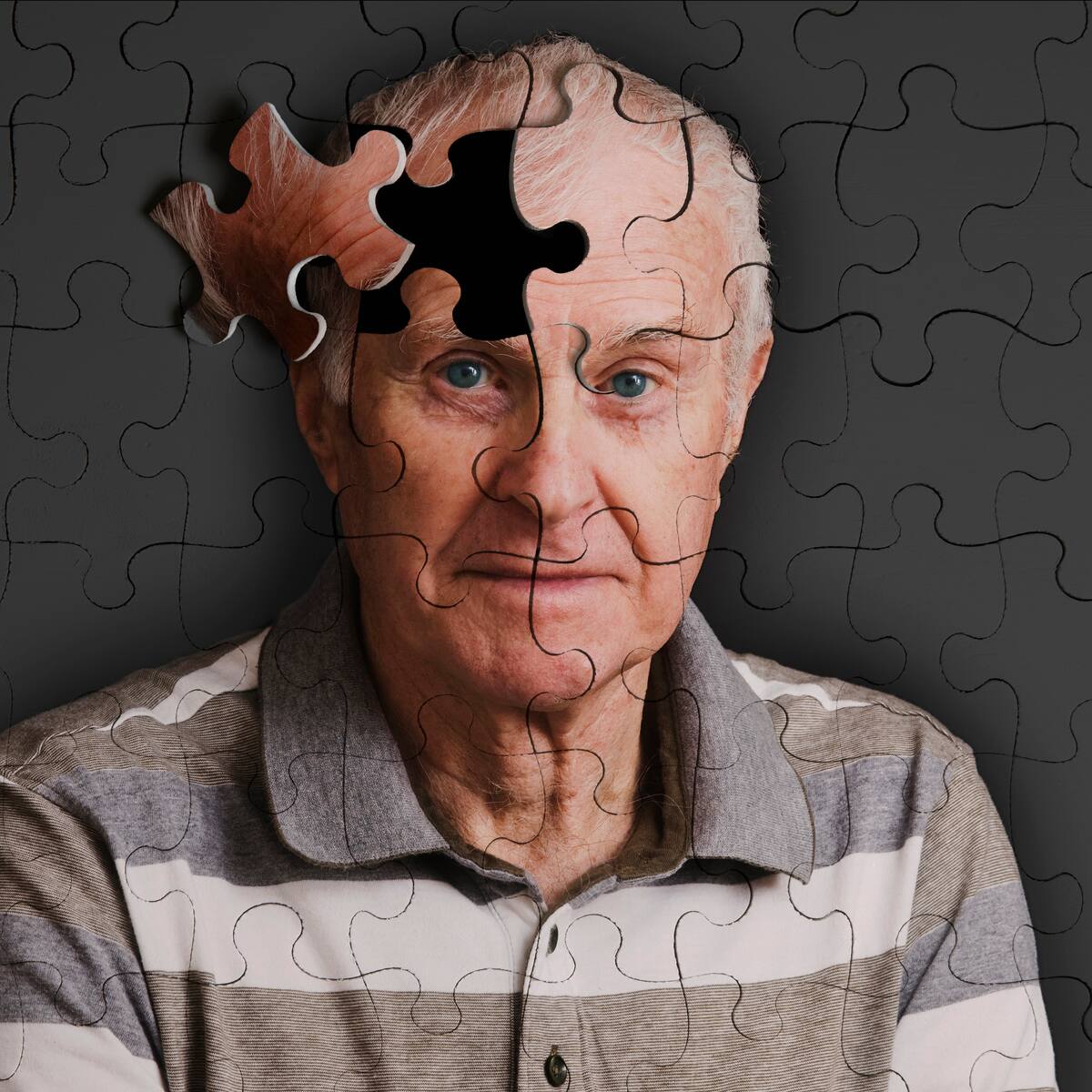 Estas son las 4 señales tempranas del Alzheimer: Así se puede anticipar para tratar la enfermedad