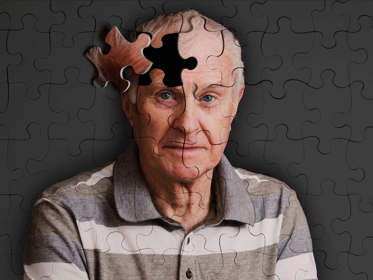 Estas son las 4 señales tempranas del Alzheimer: Así se puede anticipar para tratar la enfermedad