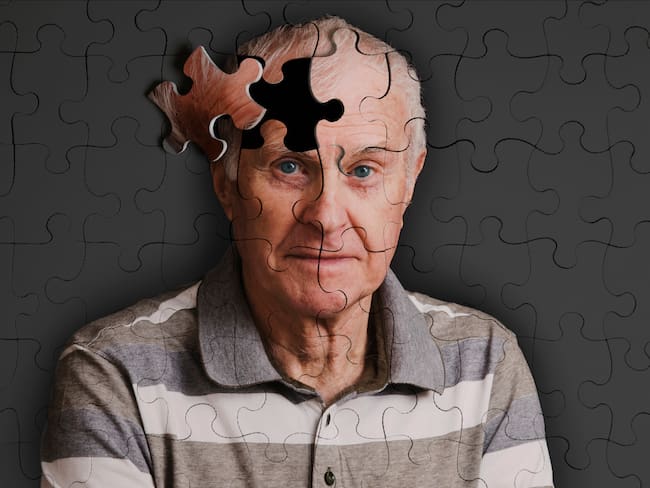 Señales tempranas del Alzheimer