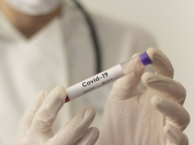 Colombia importó tecnología coreana para realizar pruebas de coronavirus