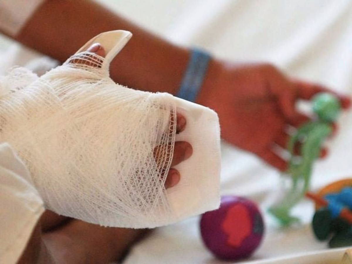 Con educación a padres de familia buscan evitar quemados con pólvora en Dosquebradas