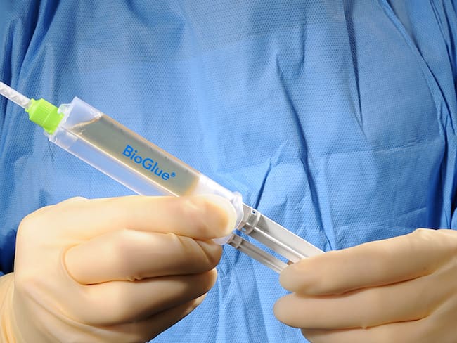 Adhesivo quirúrgico Bioglue. Cortesía: Redes Sociales