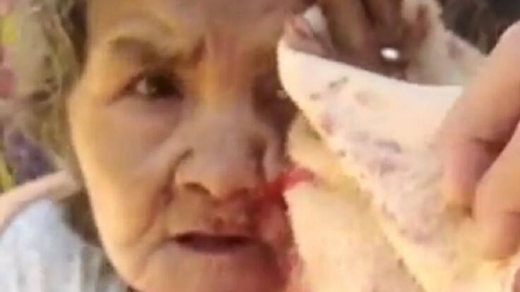 Pitbull atacó a mujer de 80 años en la Cumbre