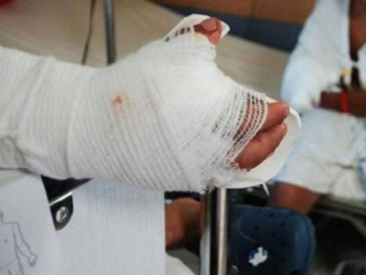 En Bello un hombre se voló un dedo con una papeleta