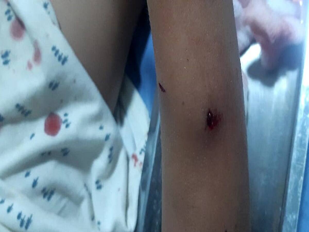 Un niño quedó herido en un tiroteo entre Ejército y delincuentes en Córdoba