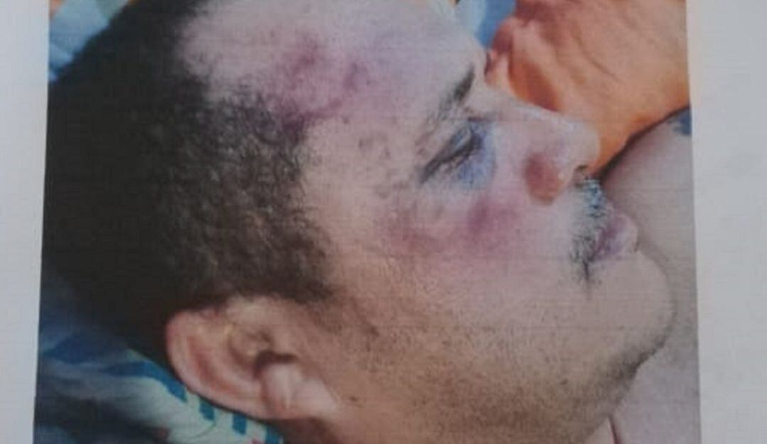 Imágenes de la agresión denunciada por el taxista