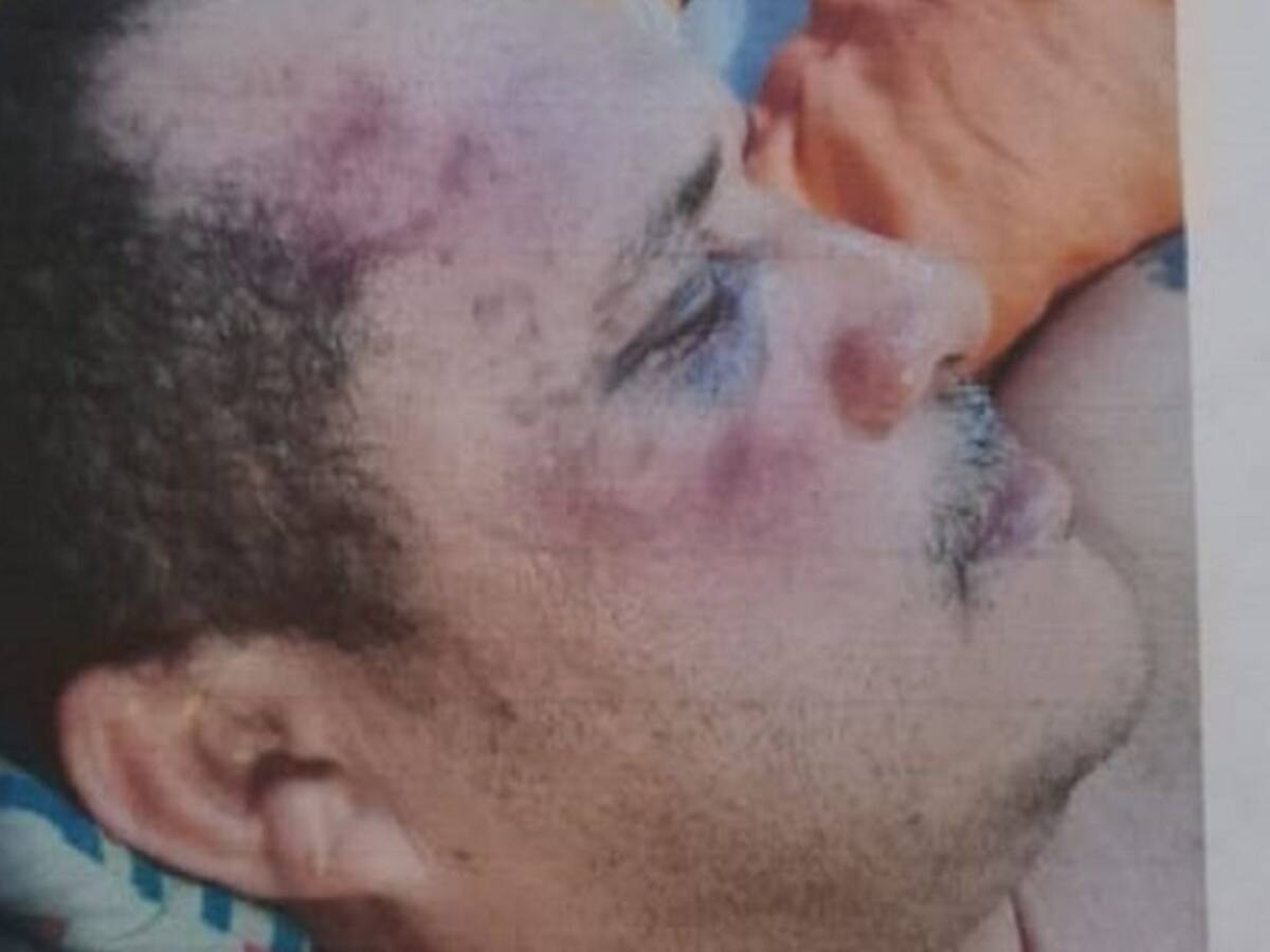 Taxista denuncia que fue agredido por agentes de Sijin