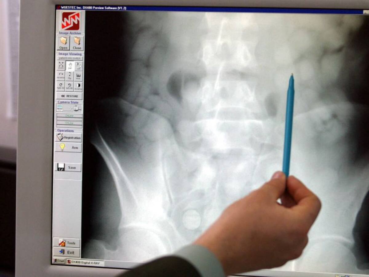 Fallece hombre luego de ingerir varias cápsulas de cocaína en Cartagena