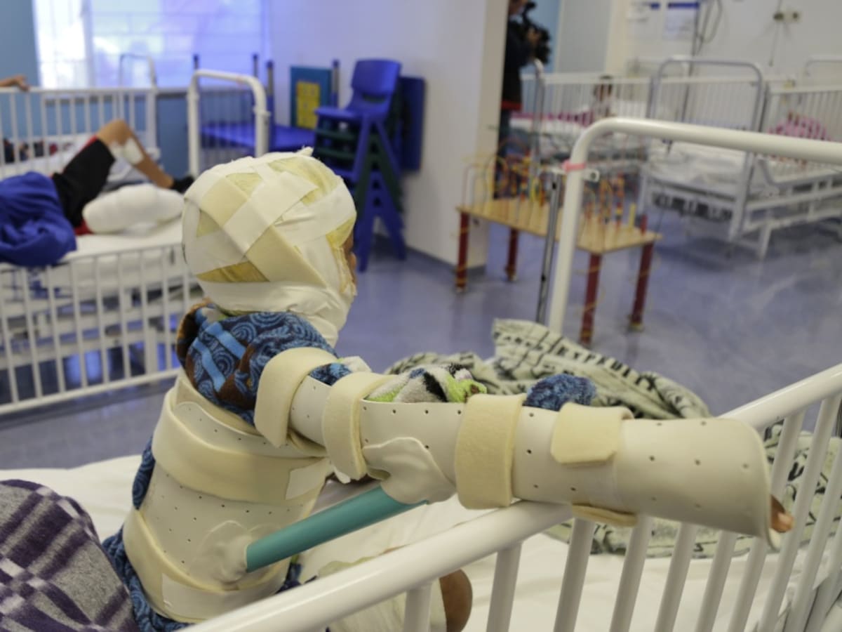 El balance de quemados con pólvora en navidad