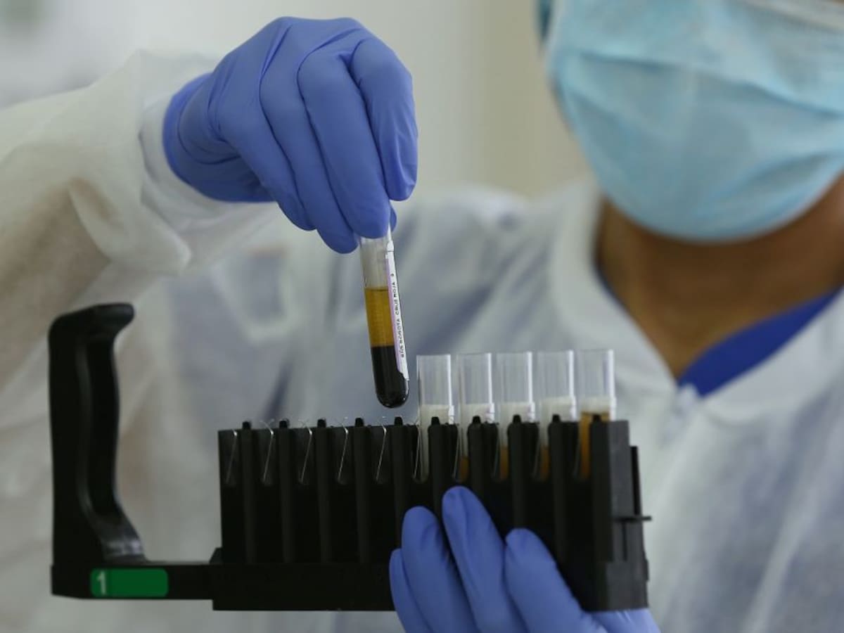 Segundo laboratorio en Cartagena recibe aval para pruebas de COVID-19