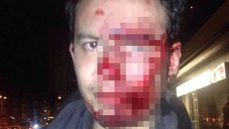 Punkeros no pusieron en riesgo vida de universitario: Medicina Legal