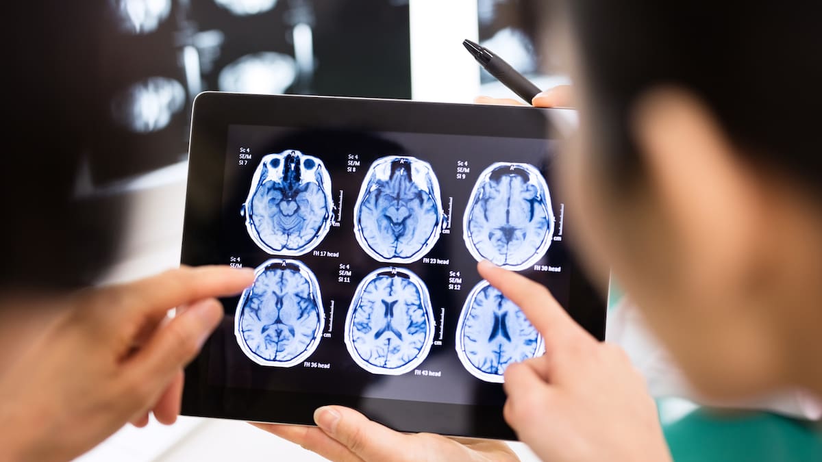 Características esenciales del neurodesarrollo