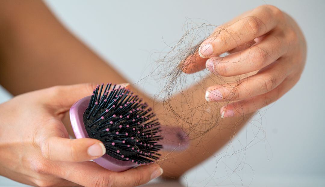 Caída del cabello.