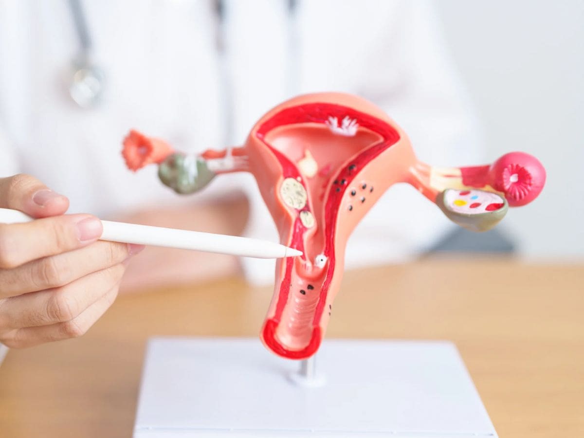 “El cáncer de ovario sigue llegando tarde al diagnóstico en Colombia”: Marcela Gálvez