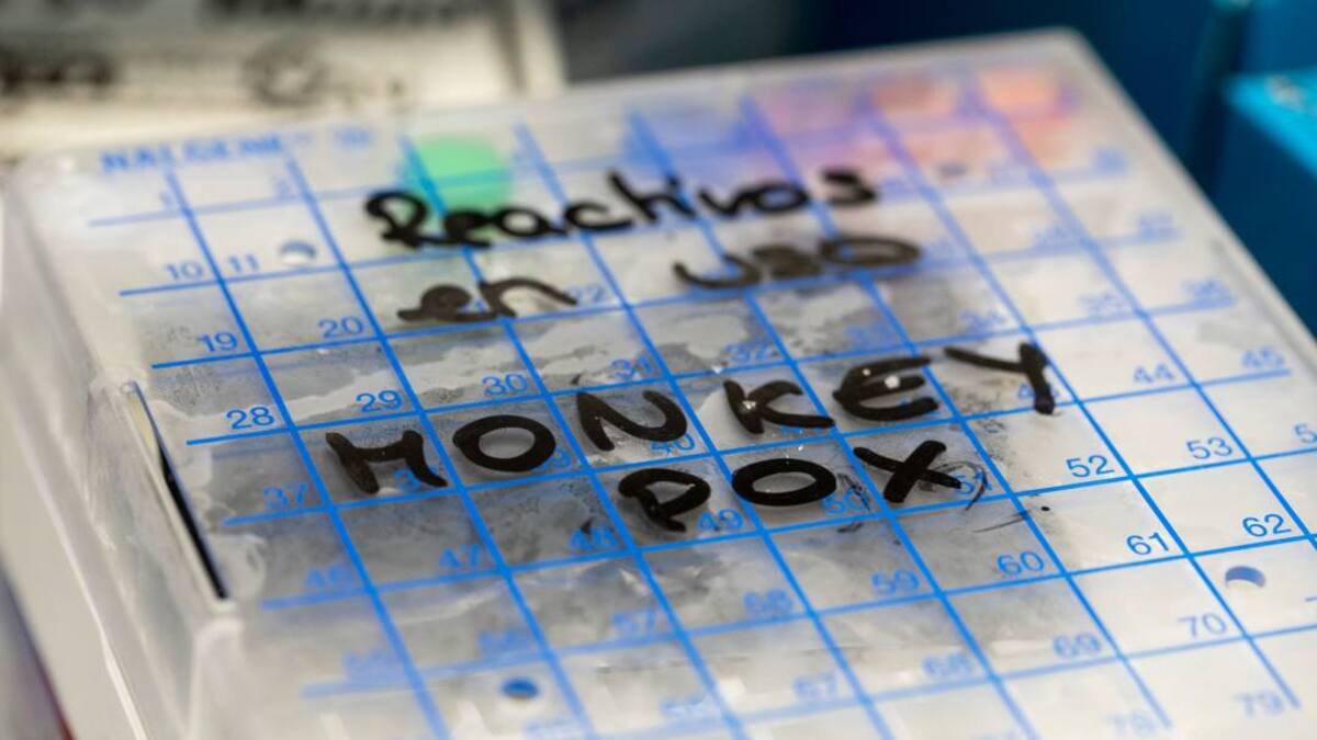 OMS confirma más de mil casos de viruela del mono en 29 países no endémicos