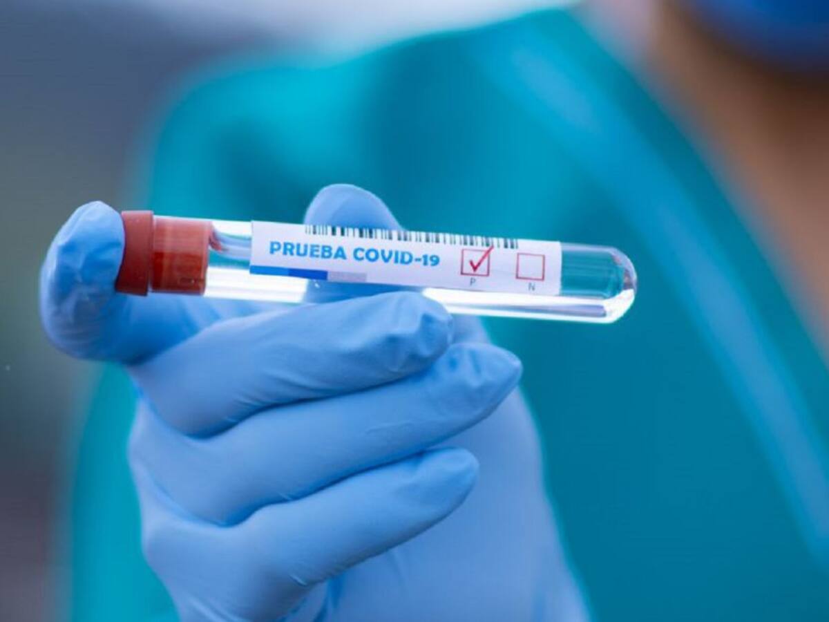 Secretaría de Salud reconoce represamiento en pruebas COVID-19