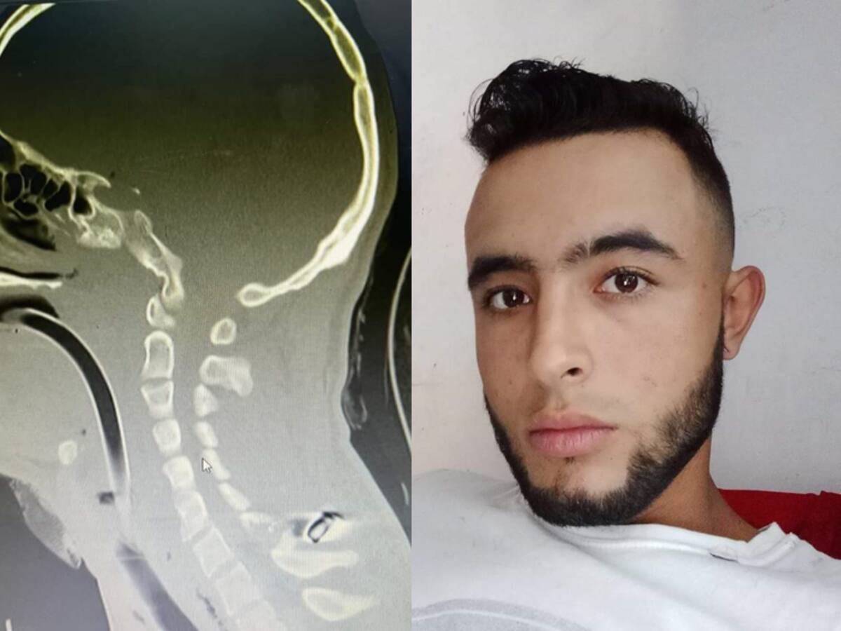 Familia de joven víctima de atraco en Ecuador sigue a la espera de su traslado a Risaralda