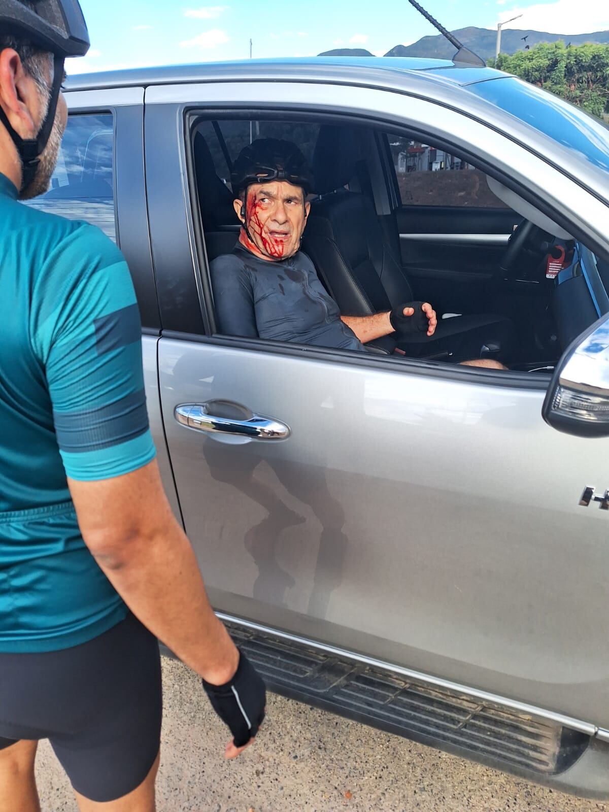 Accidente en bicicleta del diputado Juan Carlos García-Herreros