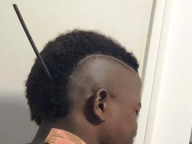 Joven en Cartagena se salvó después de tener un arpón en el cuello