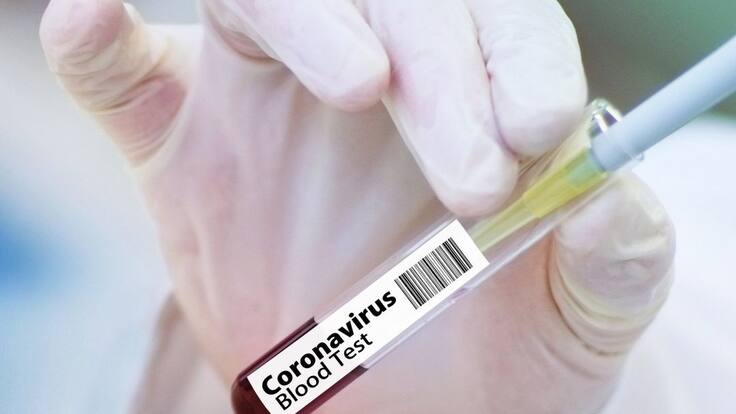 "En noviembre se podría tener una vacuna contra el coronavirus": experto