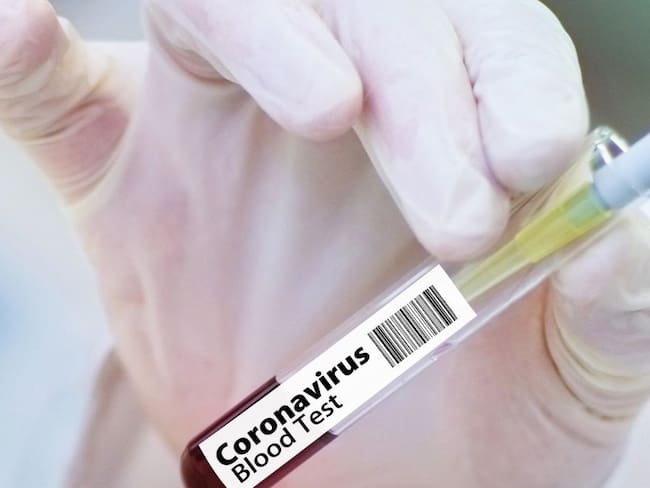 Colombia ha procesado a la fecha 21.035 pruebas de coronavirus