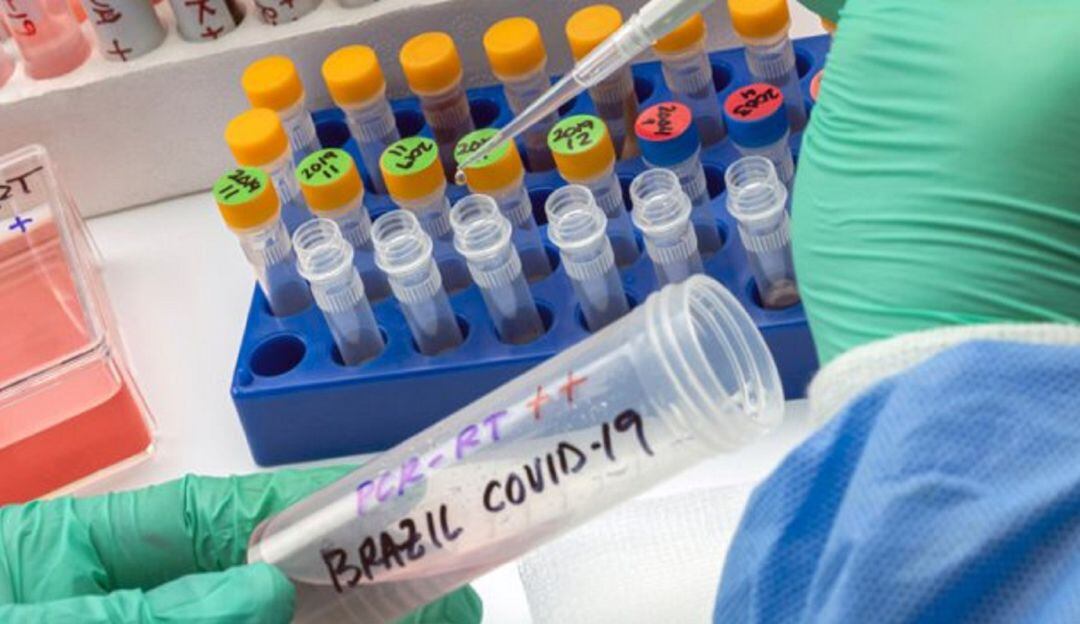 Descartan variante brasileña en cinco casos sospechosos de COVID-19