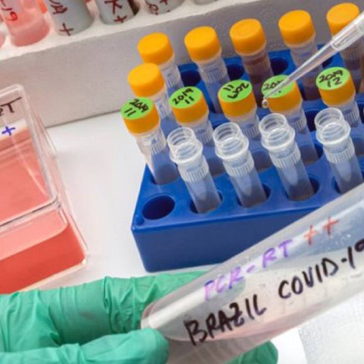 Descartan variante brasileña en cinco casos sospechosos de COVID-19