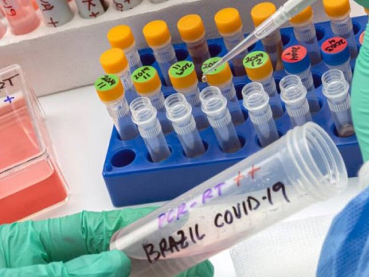 Descartan variante brasileña en cinco casos sospechosos de COVID-19